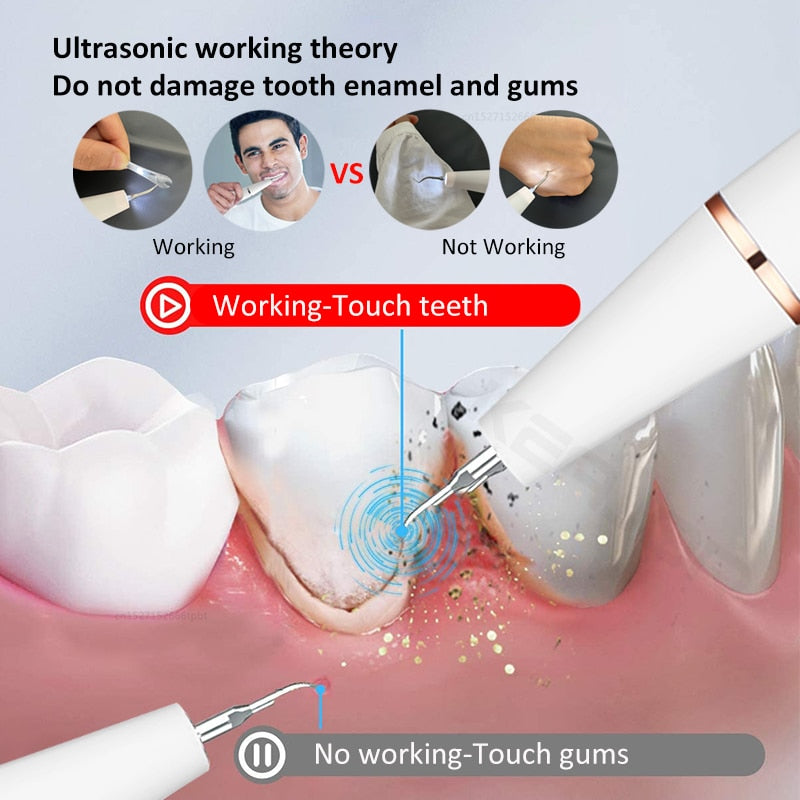 Sonic Dental Calculus Scaler Oral Teeth Tartar Remover
